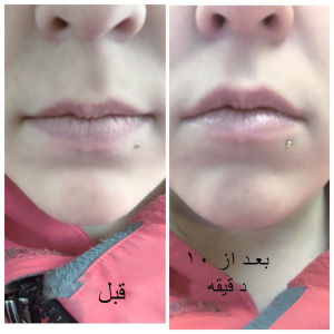 بینی